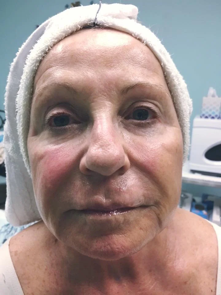 Client Highlight: Lynn