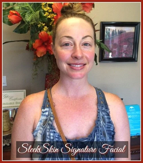 Sleekskin Aesthetics Client Experience - Alicia