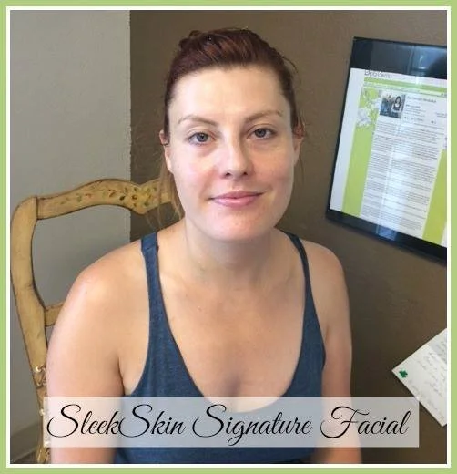Sleekskin Aesthetics Client Experience - Kristen