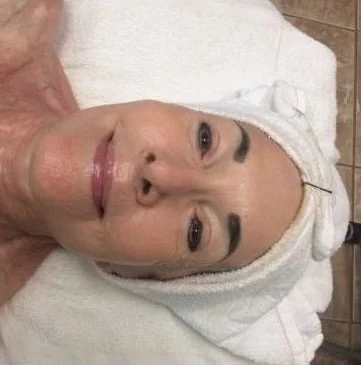 Sleekskin Aesthetics Client Experience – Sue