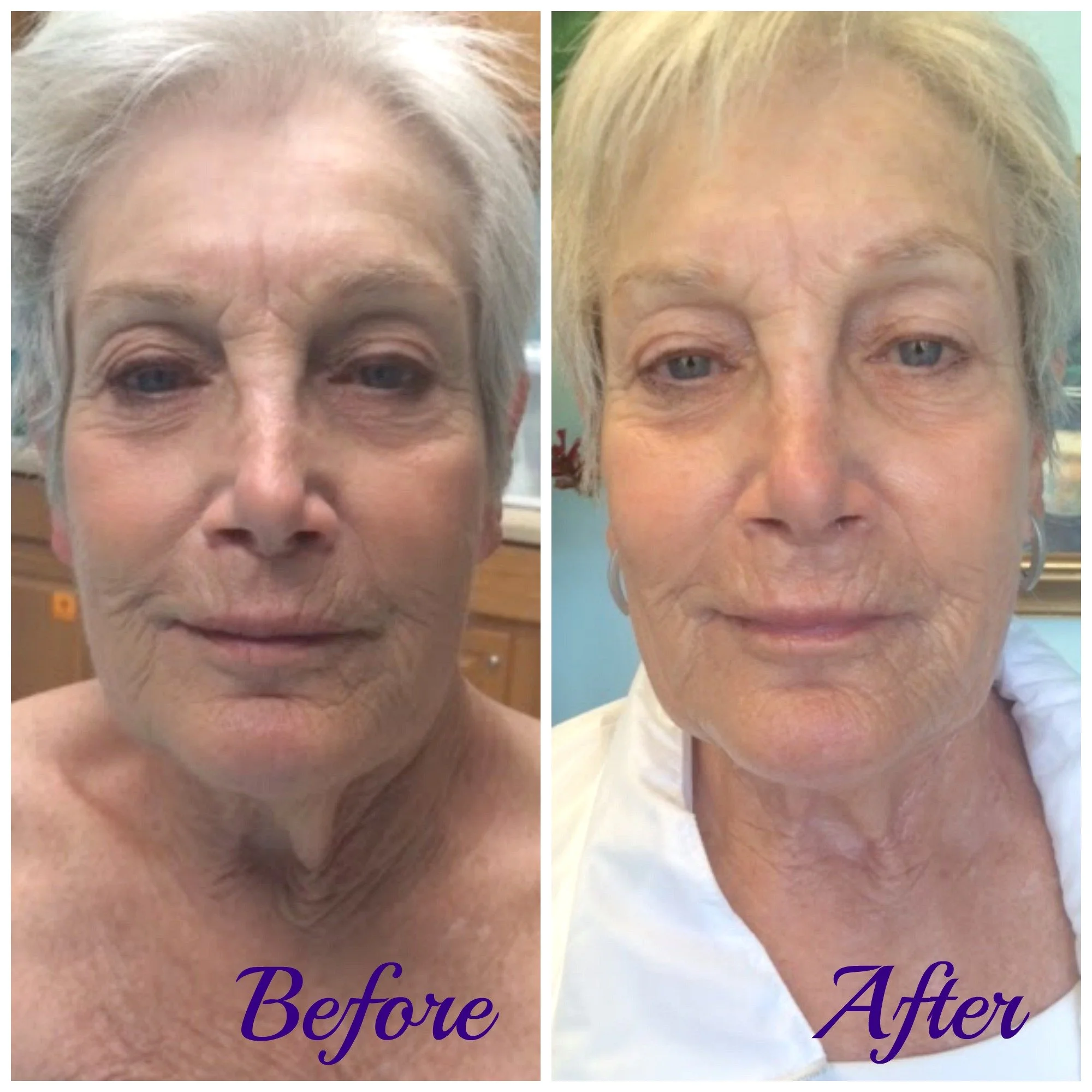 Customer Highlight: Carol K.