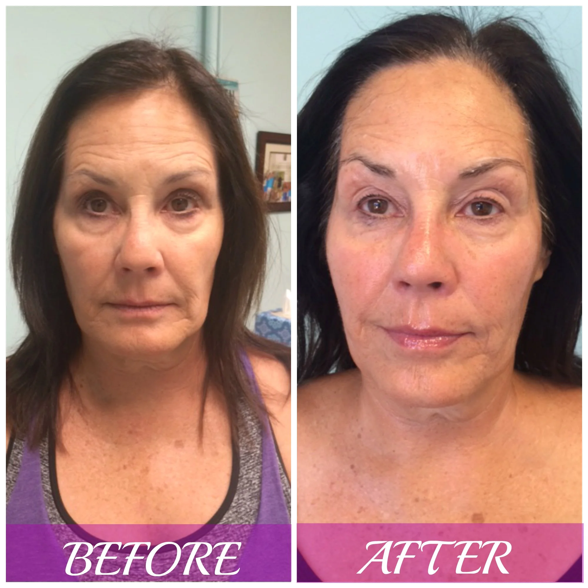 Client Before/After