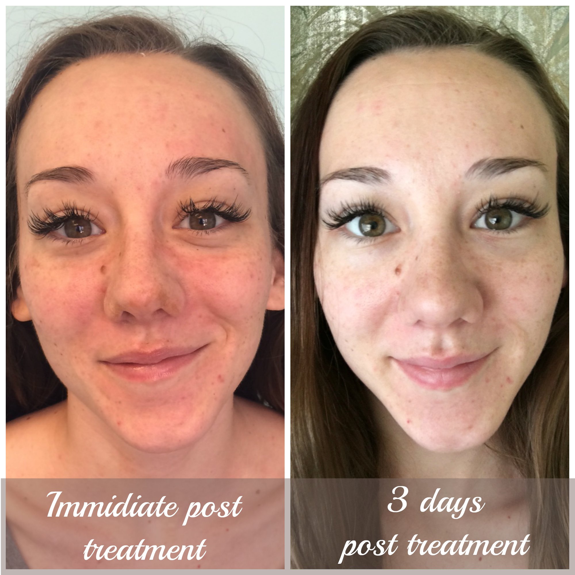 Client Before/After: Cristen F.