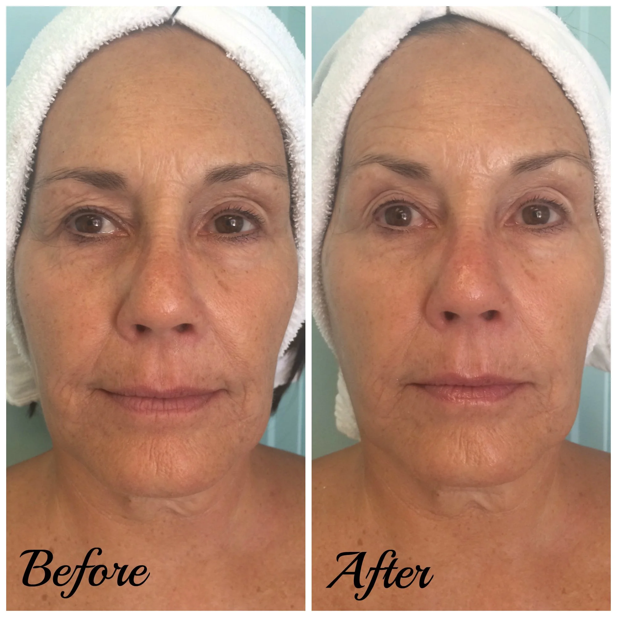 Client Before/After: Molly S