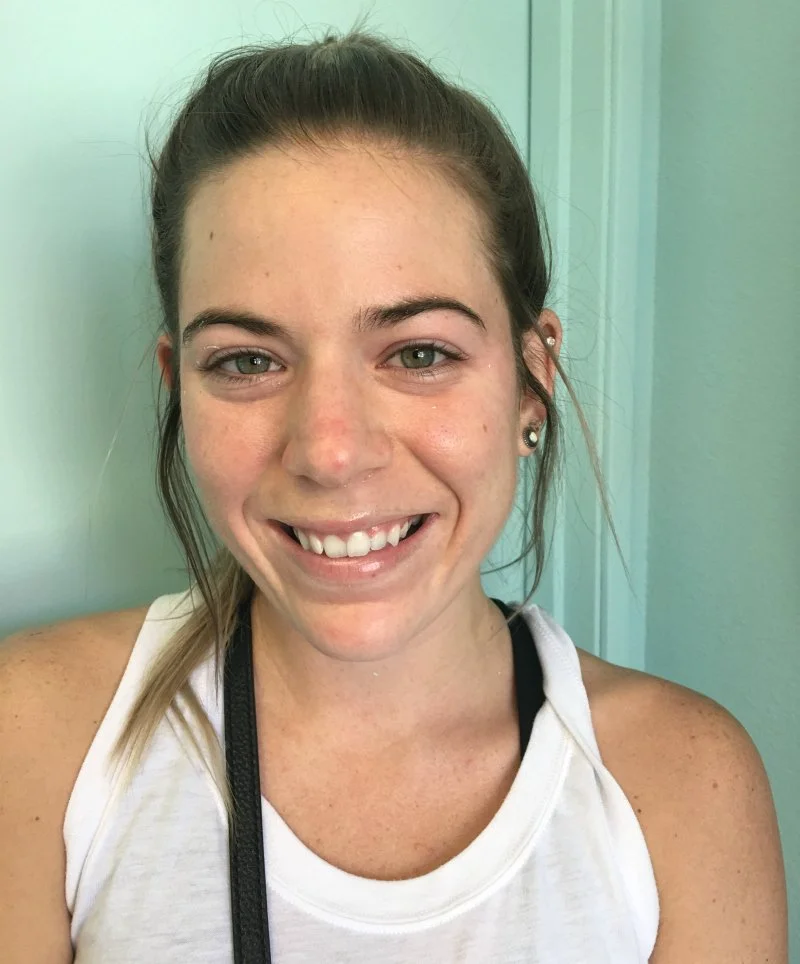 Sleekskin Aesthetics Customer Highlight: Mallory