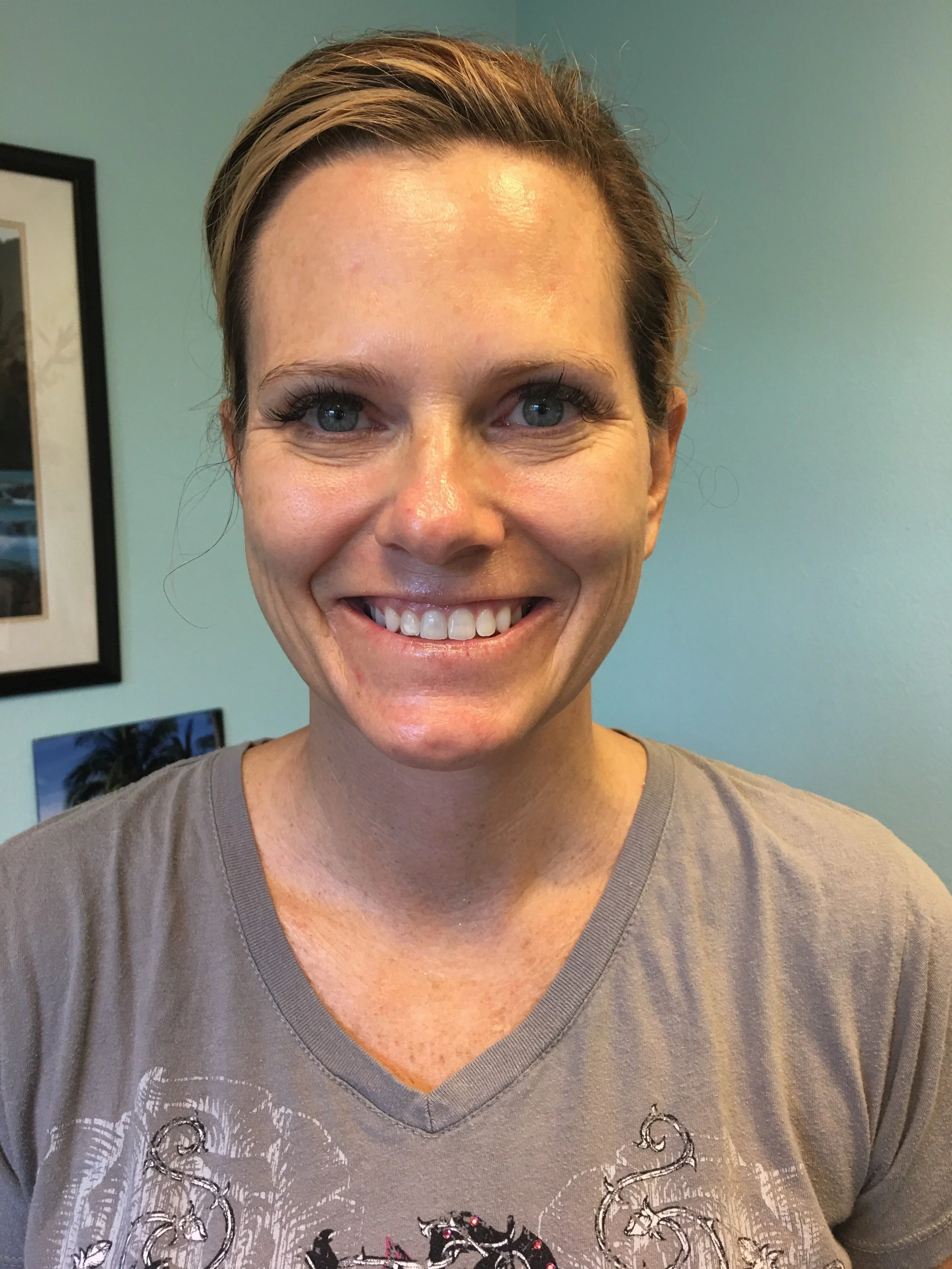 Sleekskin Aesthetics Customer Highlight: Joalice