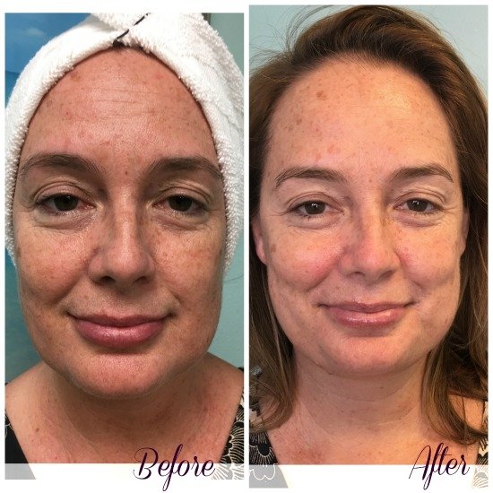 Customer Highlight: Jodie