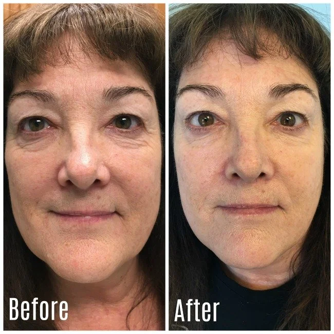 Customer Highlight: Lisa