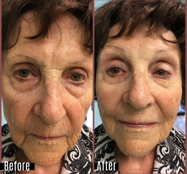 Client Highlight: Diane