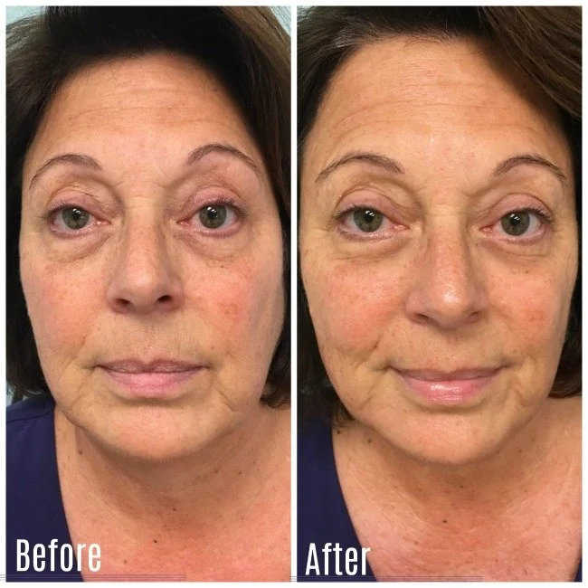 Customer Highlight: Lori