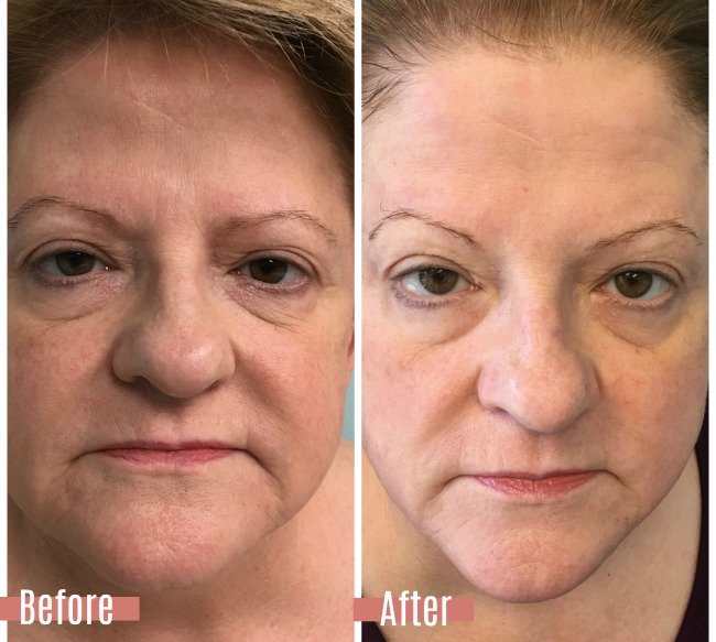 Customer Highlight: Donna