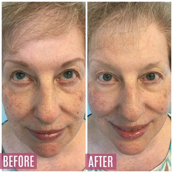 Customer Highlight: Dana