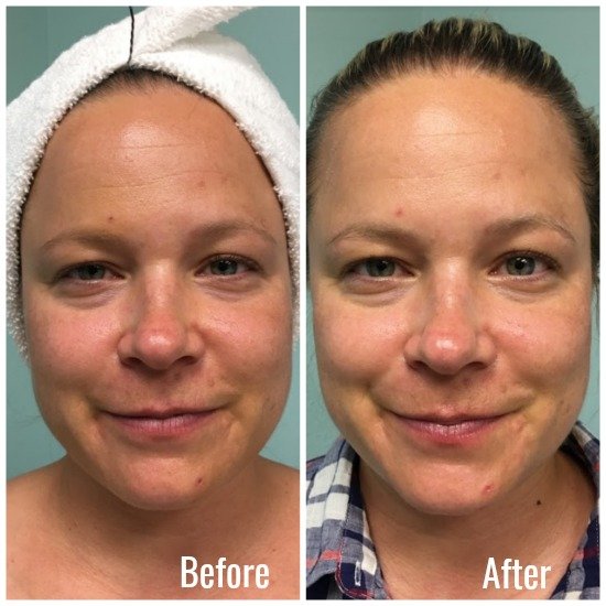 BeforeAfter5.jpg