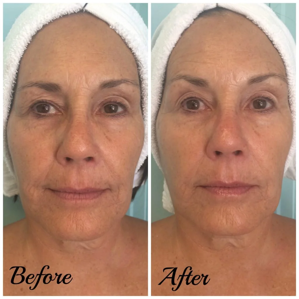 Molly-BeforeAfter-1024x1024.jpg