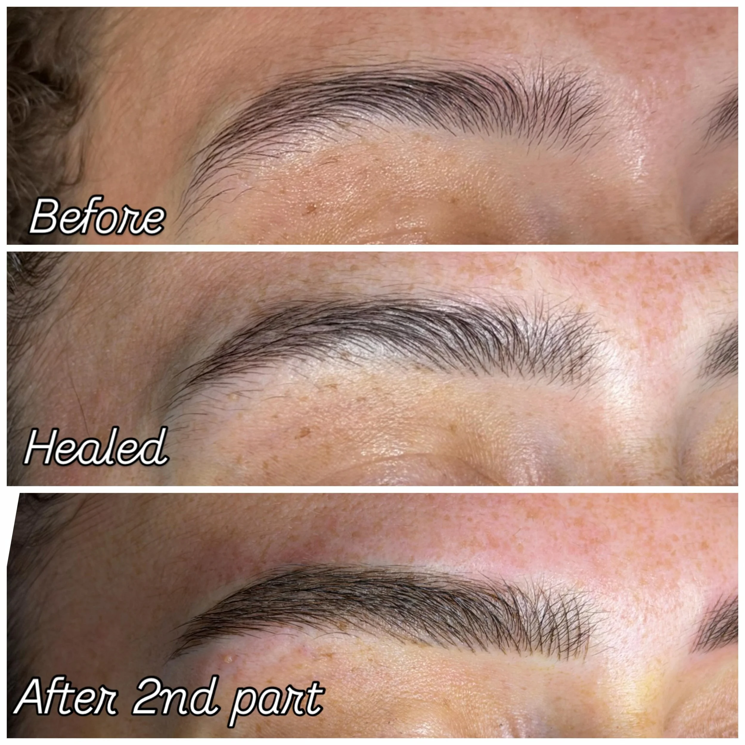 The real magic happens after healing. ✨

Before ➡️ Healed ➡️ Perfected

Natural, soft, and effortlessly defined brows designed to heal beautifully and last.

🤎 Customized for her features
🤎 Healed result assessed before touch-up
🤎 Final refinement