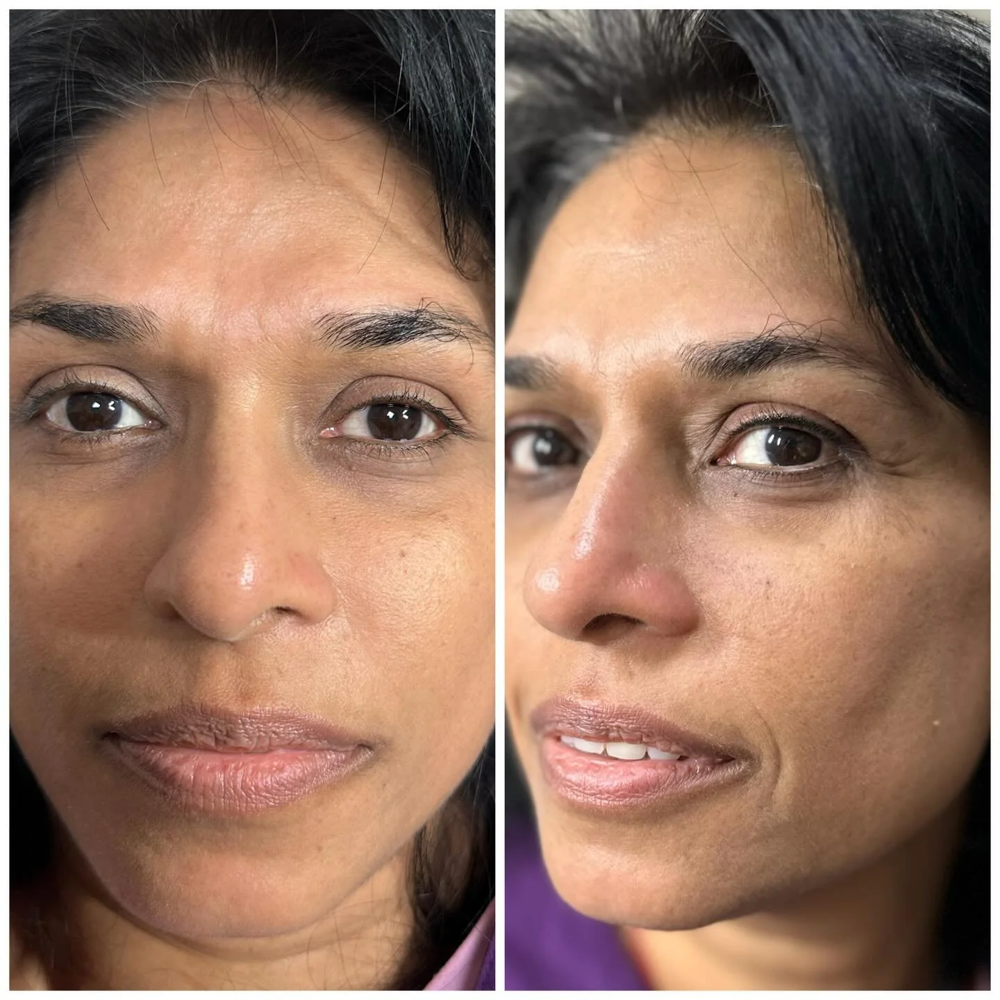A gentle Babyliner that enhances the eyes without looking &ldquo;done.&rdquo;
Just a soft definition along the lash line for an effortlessly polished look. ✨