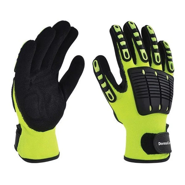 GUANTE_DE_NYLON_FLUORESCENTE_PVC_Y_NITRILO_DERMACARE__2.jpg