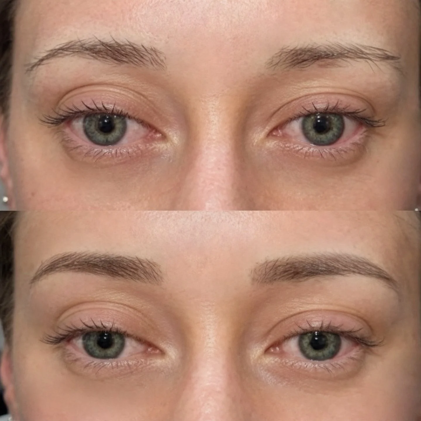 Before & After