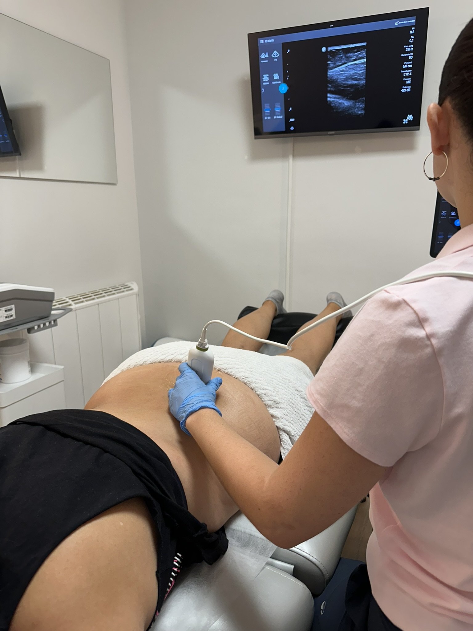 Fisioterapeuta tratando la espalda de un paciente en Burgos