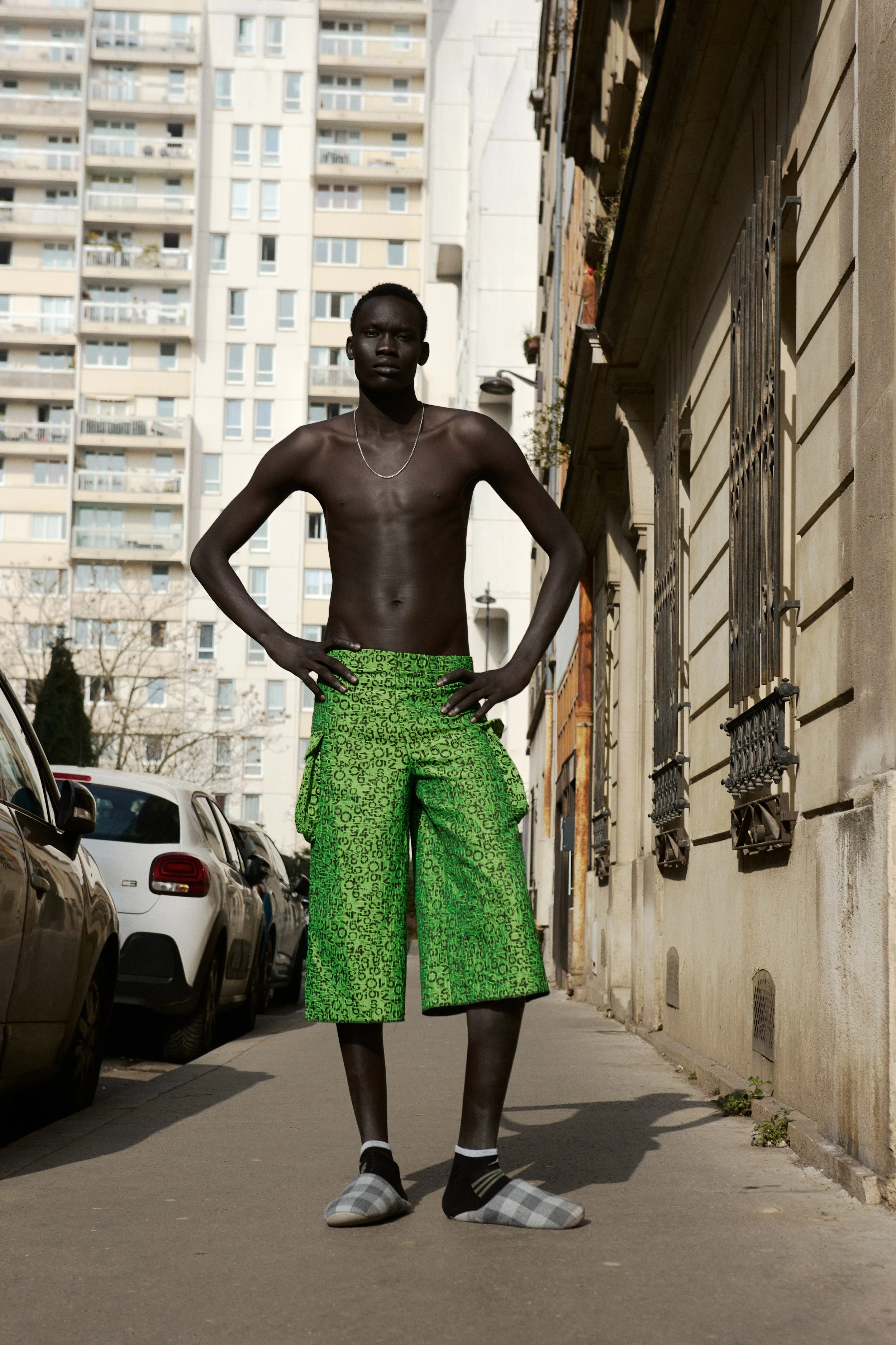 A young man standing on a city street with his hands on his hips. He is shirtless, wearing a silver chain and bright green patterned pants. His footwear consists of mismatched giant slippers and black socks with a white stripe. There are parked cars 