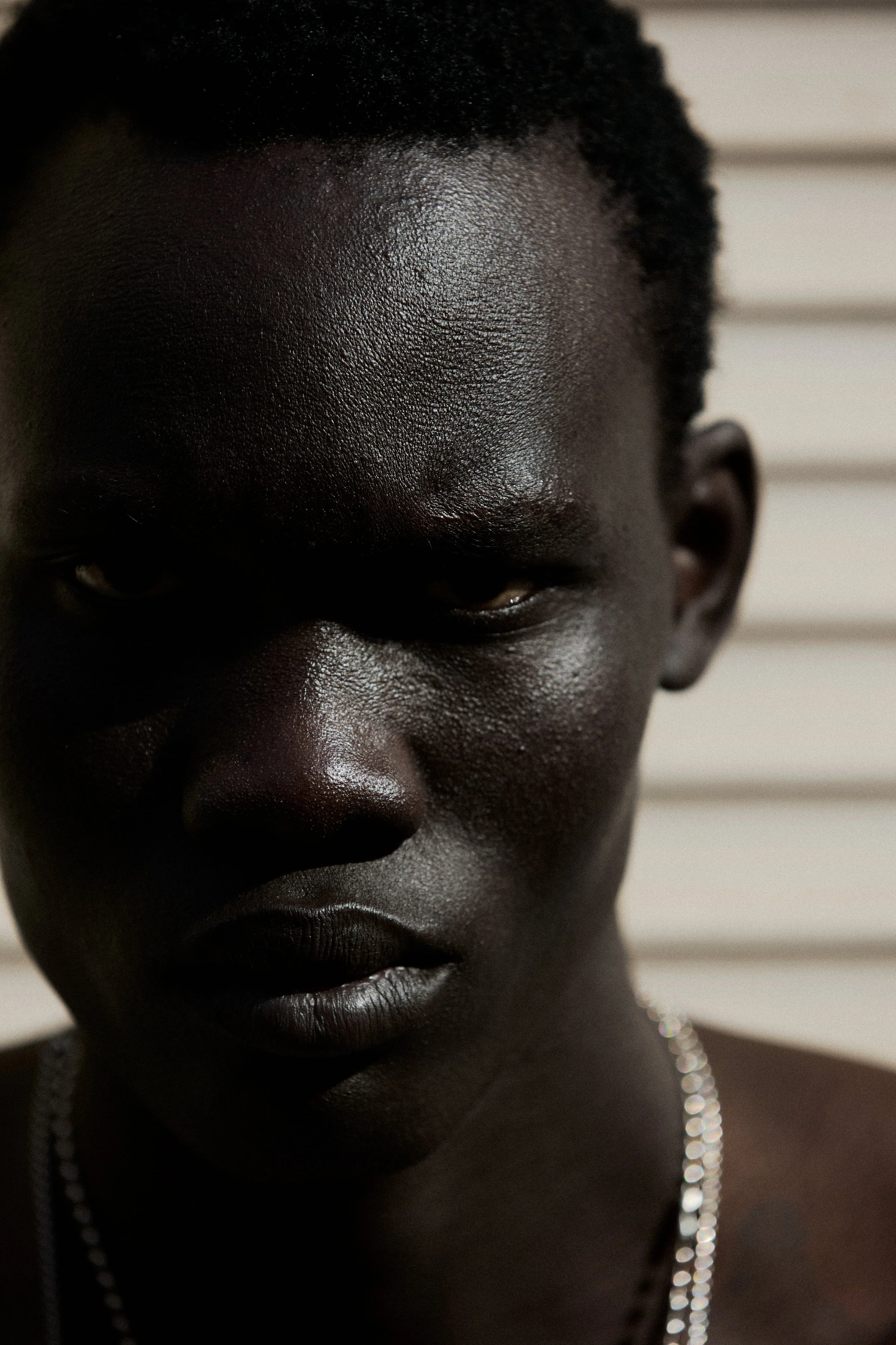Close-up of a person's face with dark skin, partially visible with a focus on the forehead, eyes, nose, and lips, against a neutral background.