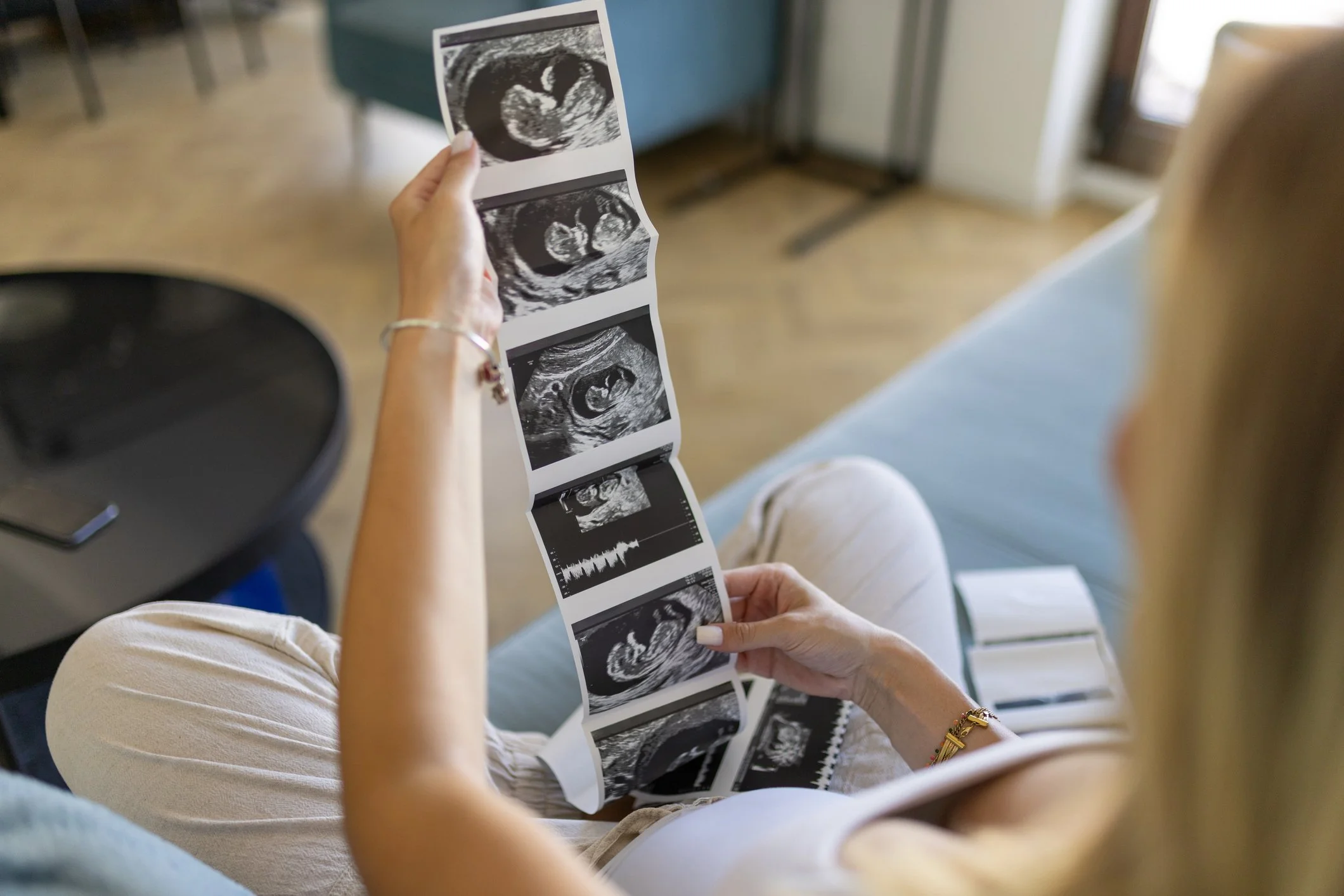 Person holding an open strip of ultrasound images showing early pregnancy scans, sitting in a room with a window and wooden floor.