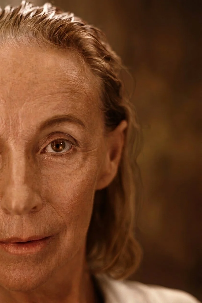 blepharoplasty before.jpg