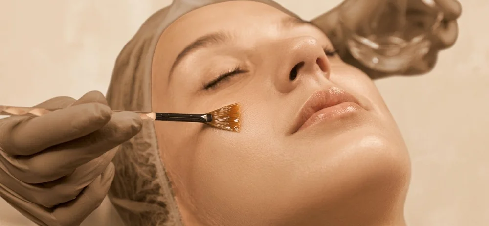 chemical peels - solunexamedispas