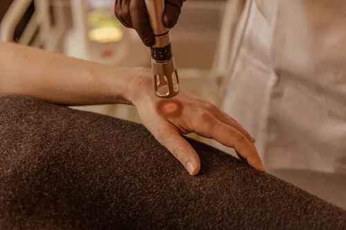 Wound Healing Treatment at Solunexa Medispa
