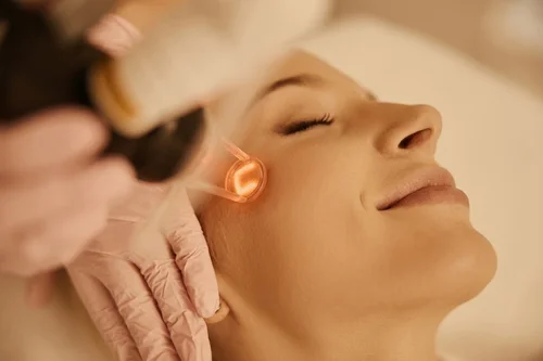 Skin Rejuvenation with Laser Treatment at Solunexa Medispa