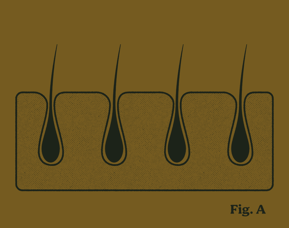 A diagram showing hair follicles embedded in the skin's epidermis, with hair strands extending upward.