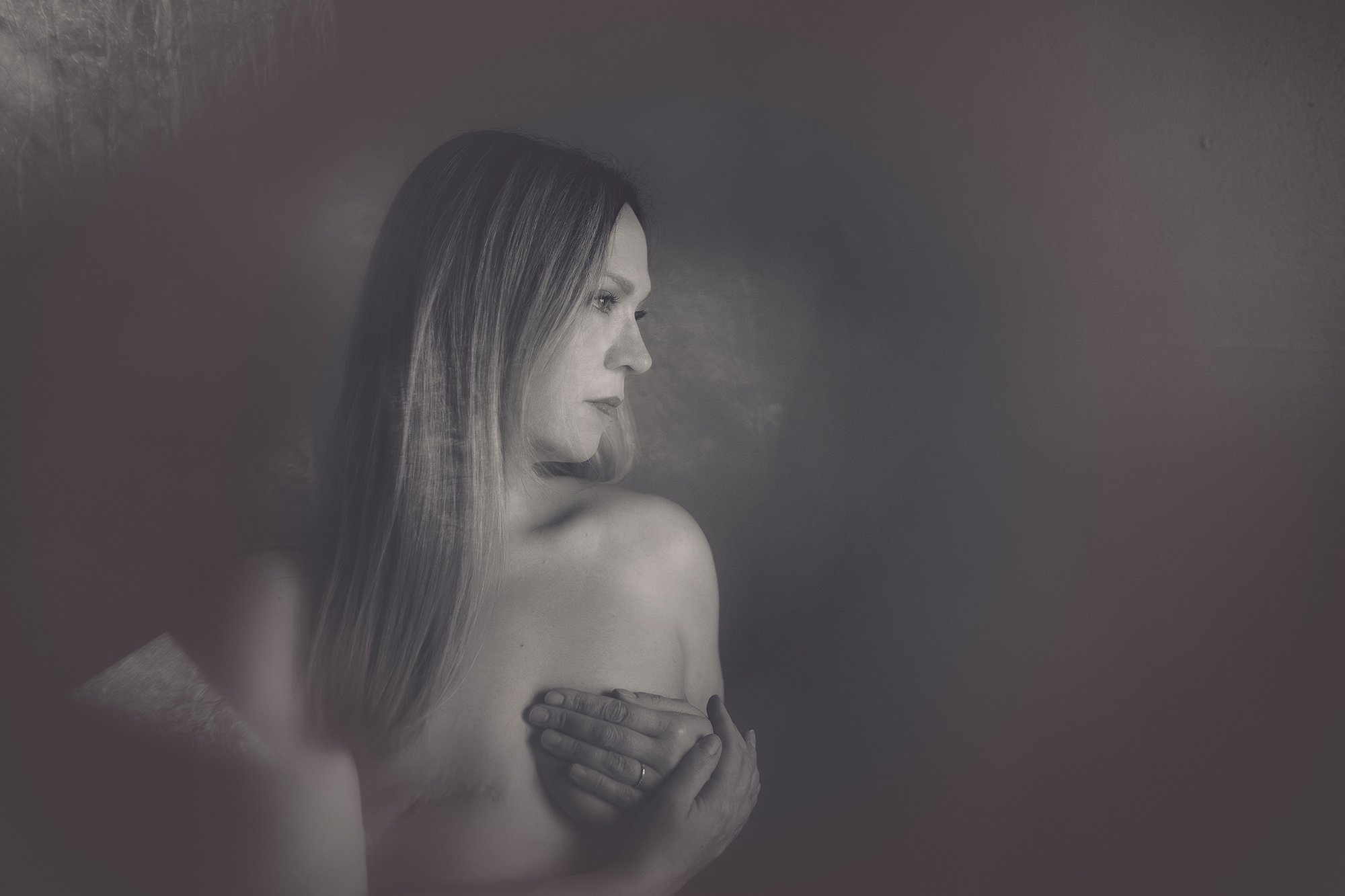 Scars: A Self-Portrait Series
