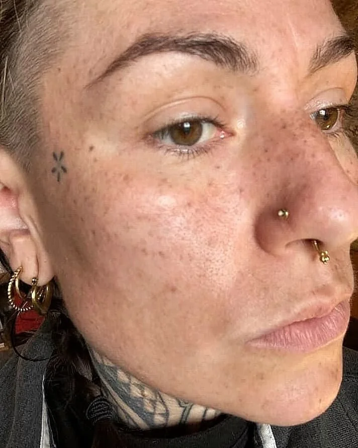 Zoom sur le visage d'une personne avec des taches de rousseur toutes neuves, plusieurs piercings, et un petit tatouage. Cheveux courts et bouclés, et maquillage minimal.