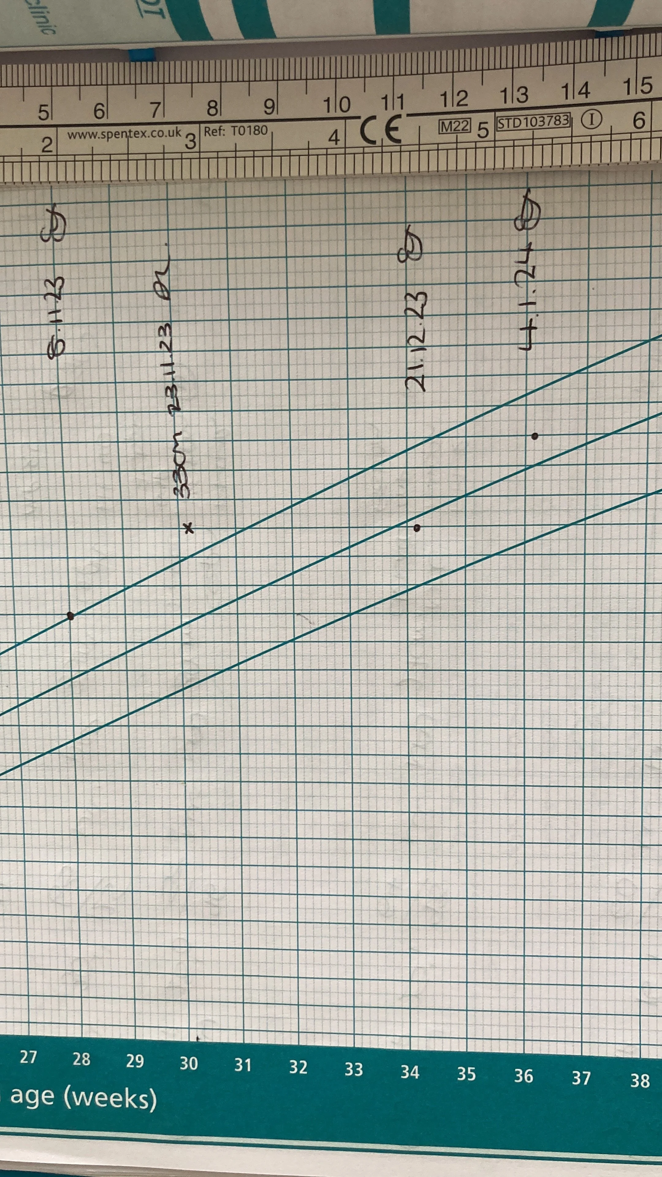 “Your baby is measuring big, so we’d recommend an induction”