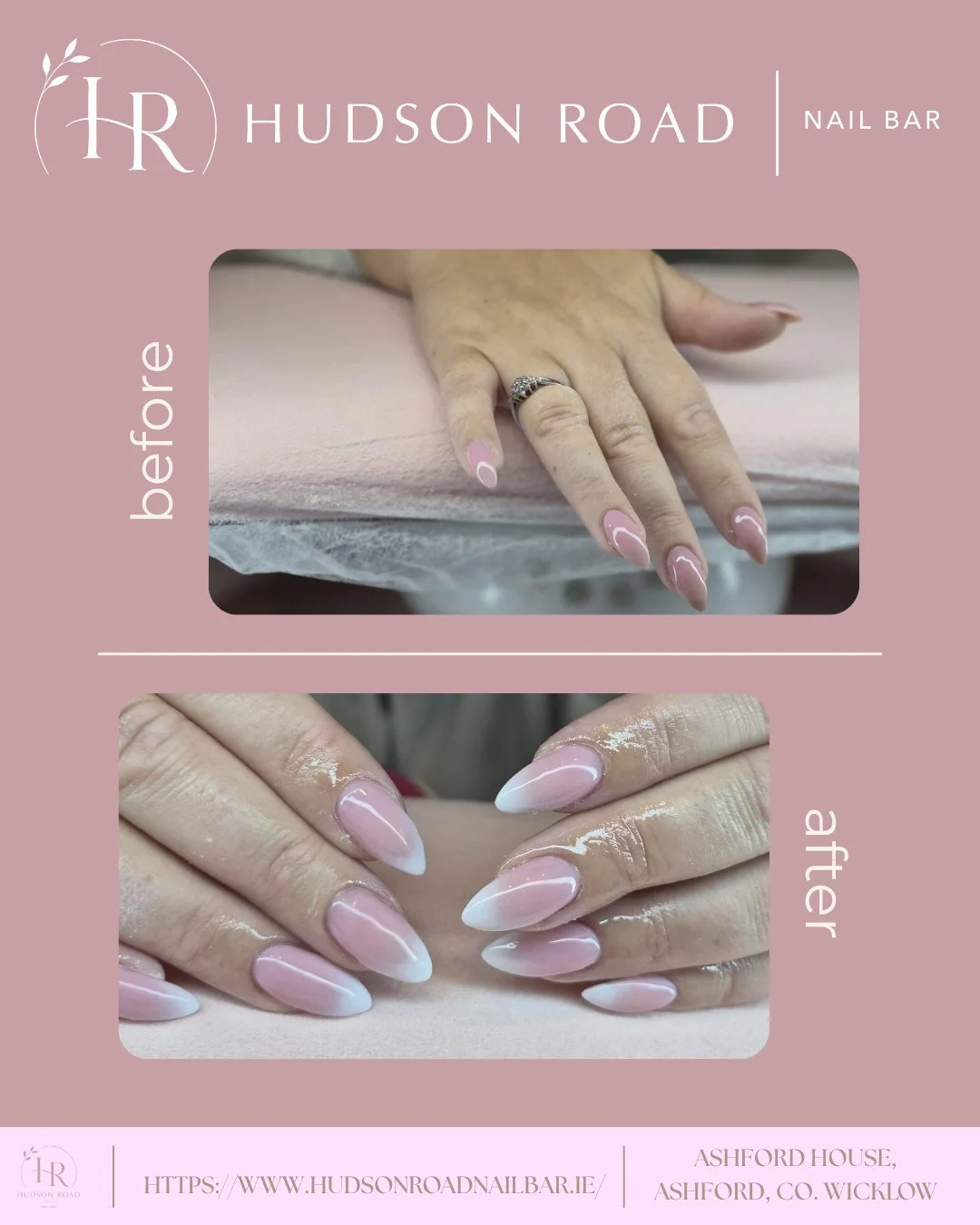A fresh set just hits different! There&rsquo;s nothing better than a nail transformation. Swipe to see another before &amp; after!

Have you booked your next set yet? Book now at www.hudsonroadnailbar.ie (link in bio). We also have some Saturday appo