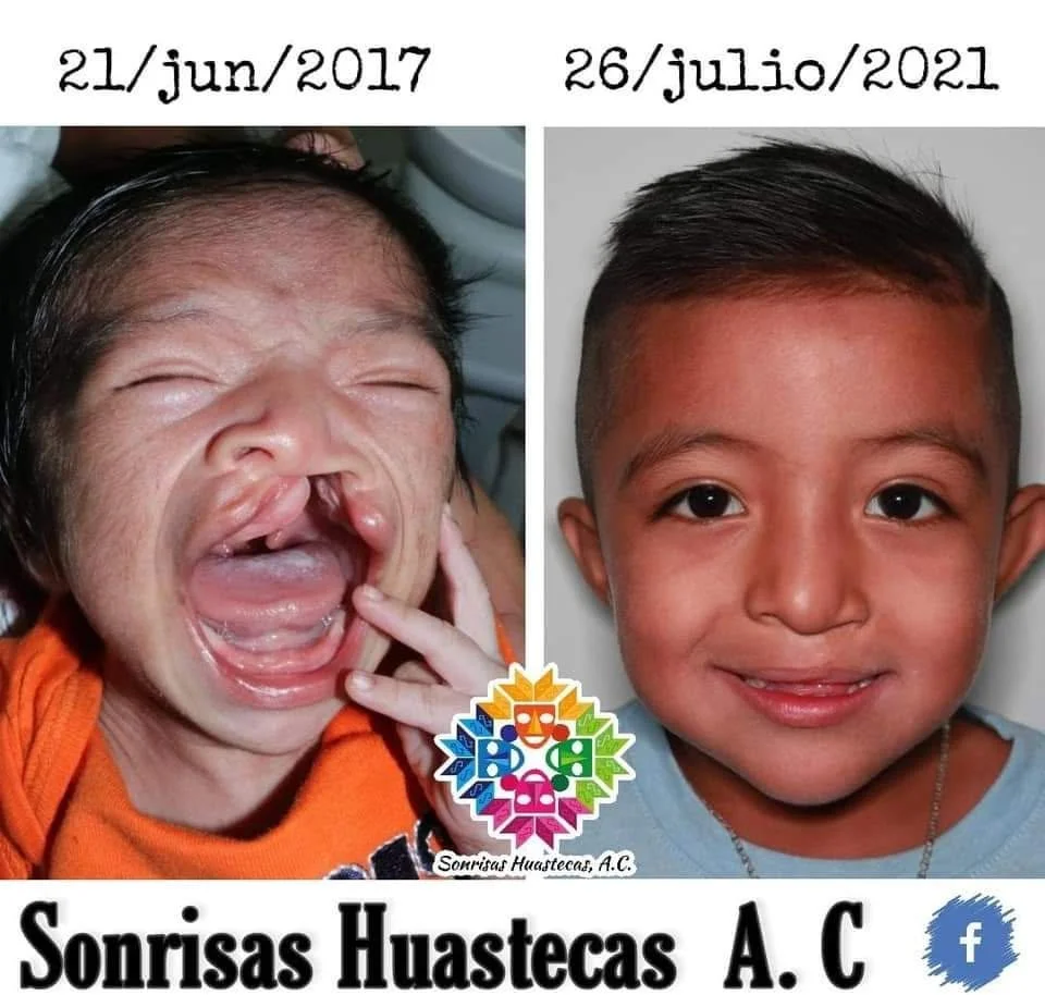 Primer Caso Clínico