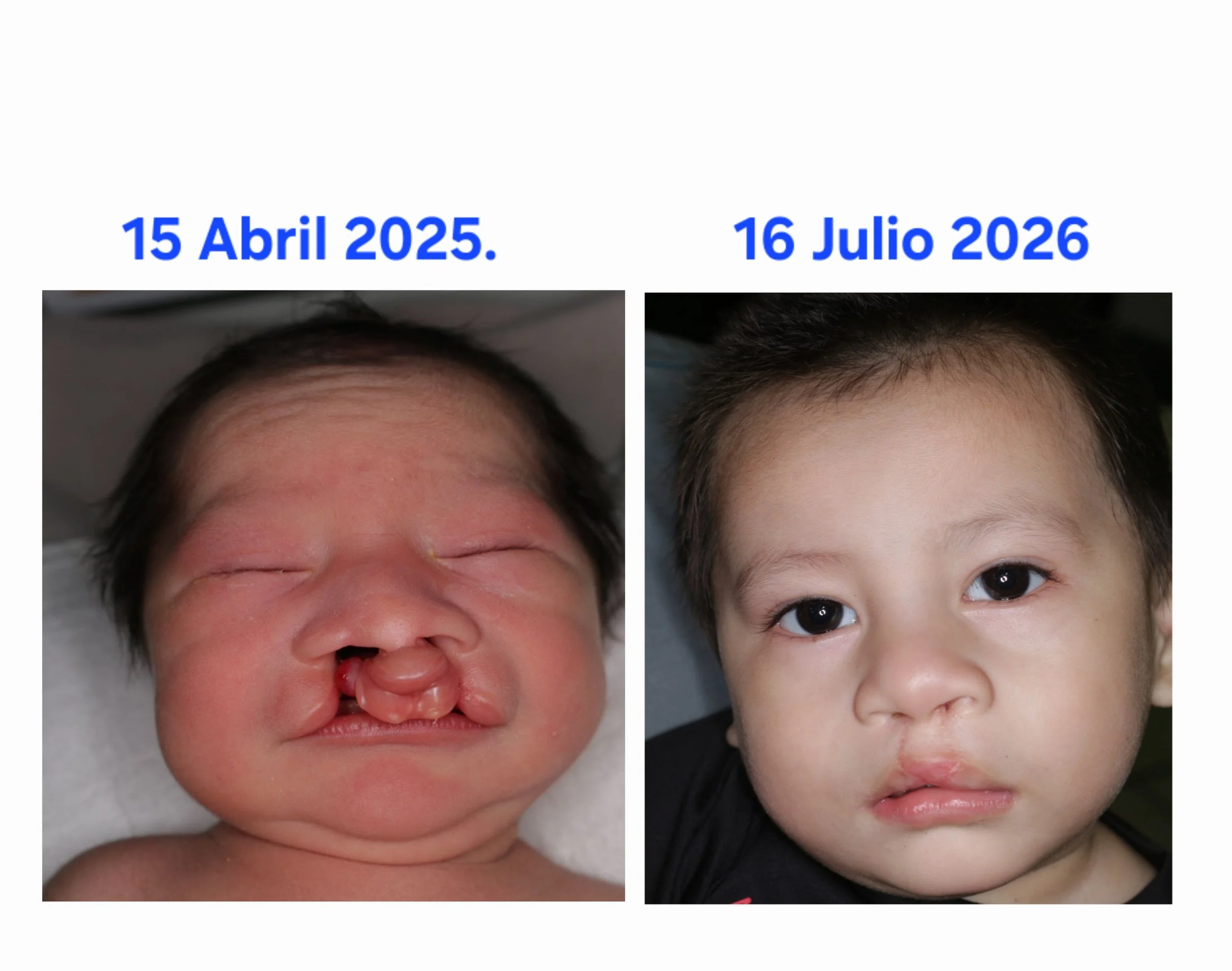 Segundo Caso Clínico