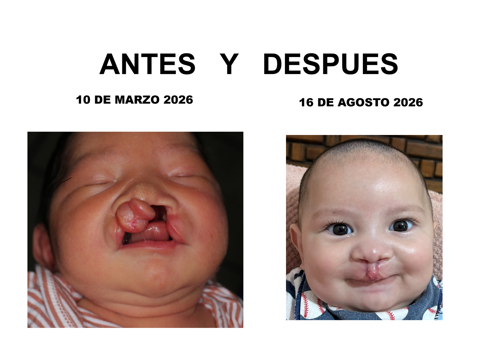 Tercer Caso Clínico