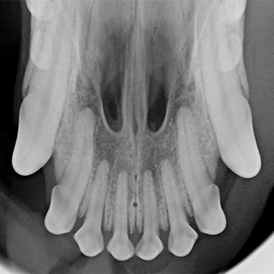 X-ray of a human mouth showing teeth and nasal cavity