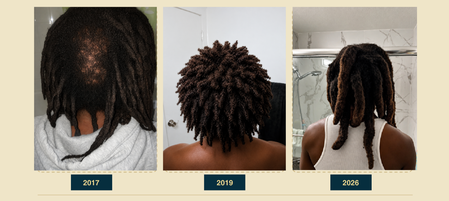 Progress photos of a person's hair growth and styling from 2017 to 2026, showing the transition from dreadlocks to a fade with dreadlocks and then to natural, freeform dreadlocks.