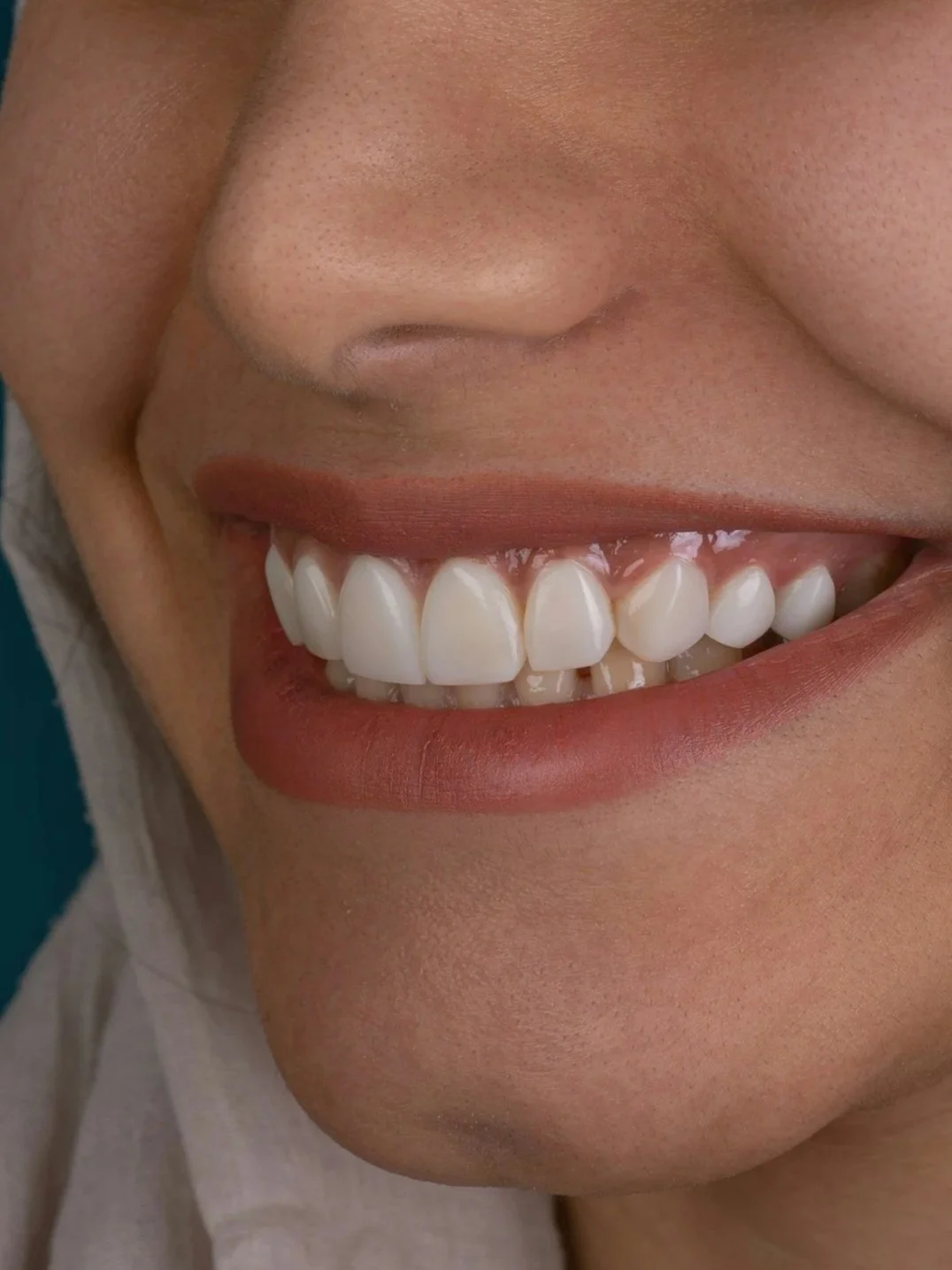 Close-up of a person's smiling mouth showing white teeth and pink lips.