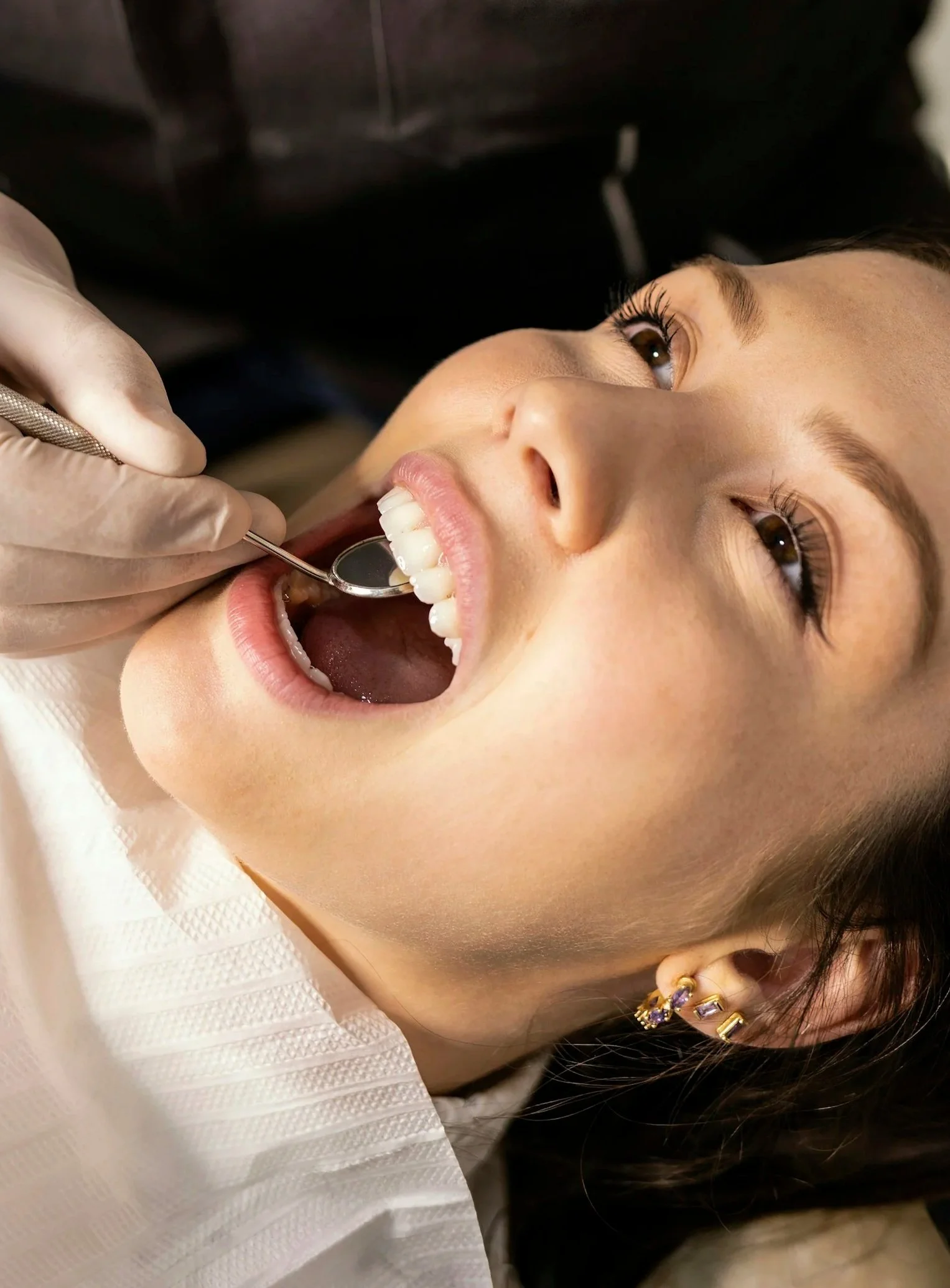 A young woman with dark hair and earrings receiving dental check-up, lying back with mouth open and a dental mirror inside.