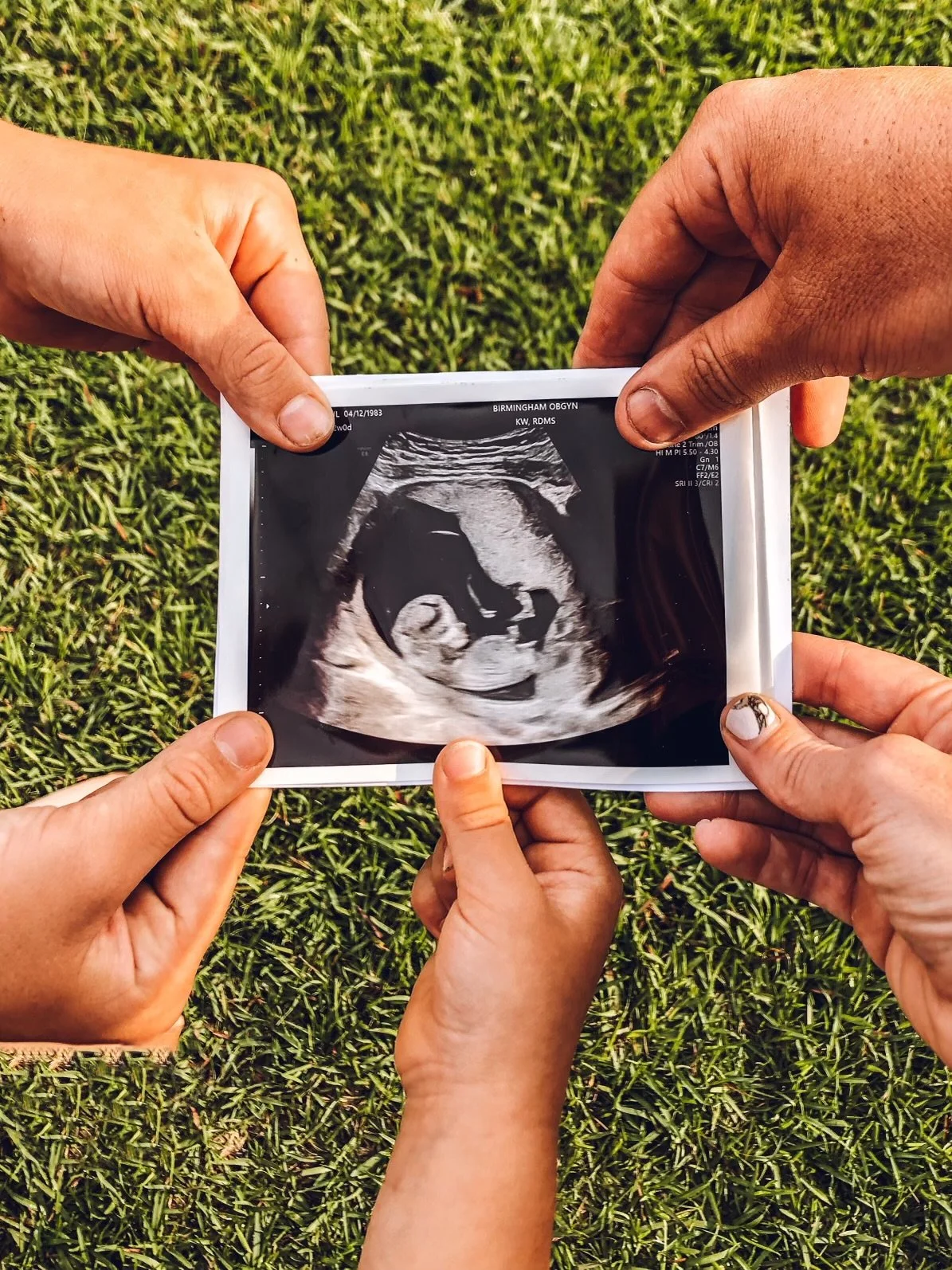 A group of people holding an ultrasound image of a developing fetus with a grassy background.