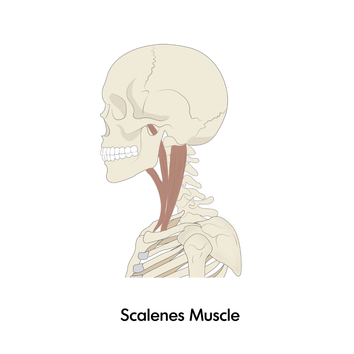 Scalenes.png