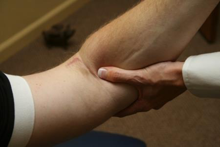 Dr. Kay Miller performing myofascial and adhesion release therapy on a patient’s arm.