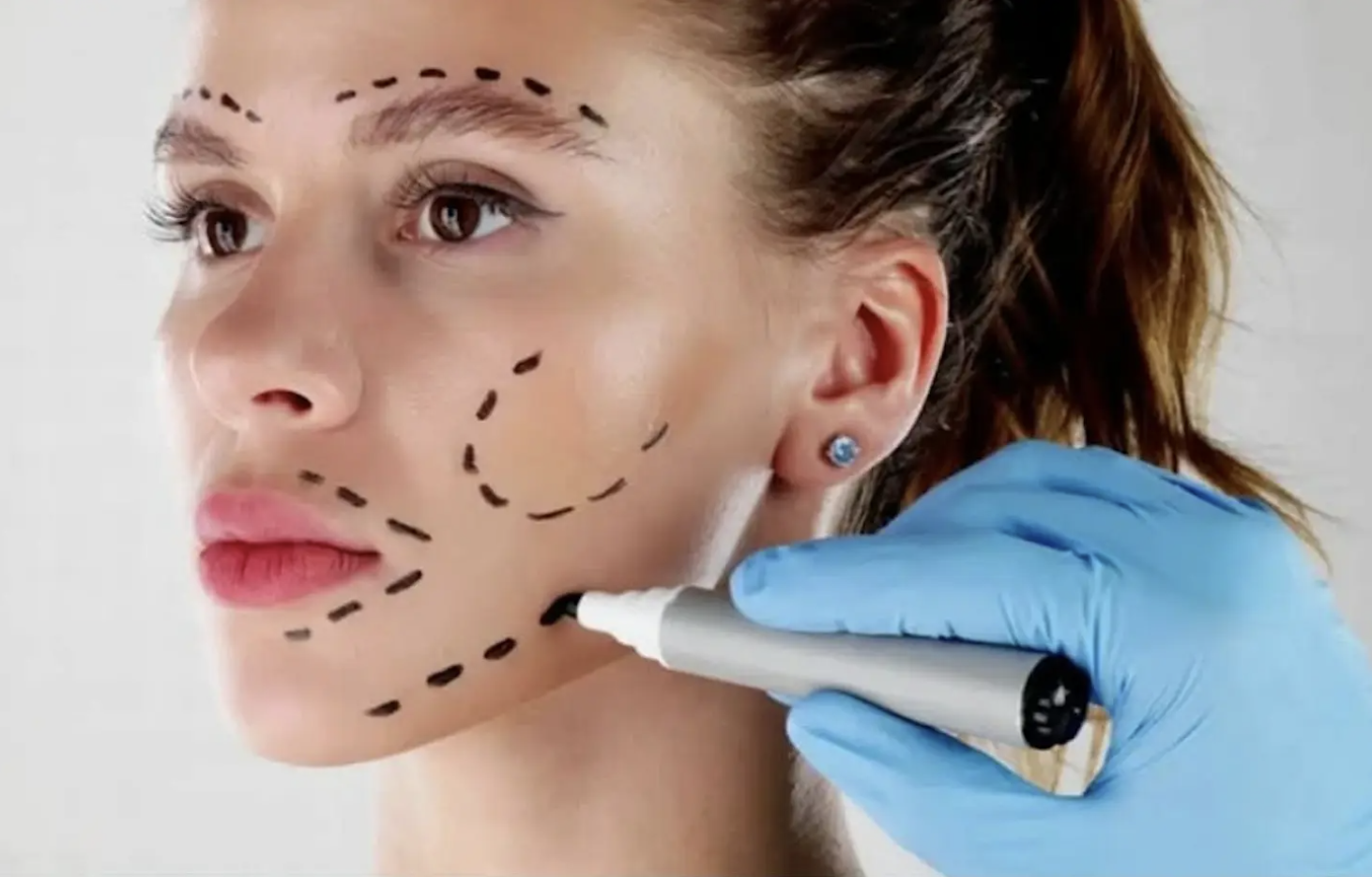 The Ethics of Using Deceased Donors' Tissue in Cosmetic Procedures — Come along!