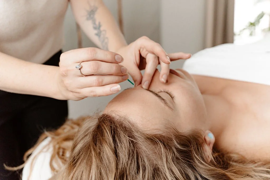 A person receiving an acupuncture treatment on their face, lying down with eyes closed.