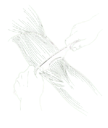 Outline illustration of a person performing IASTM on an arm with the fibers of the muscle visible