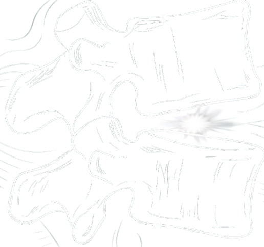 Medical illustration of a human spine with a herniated disc causing nerve compression and pain.