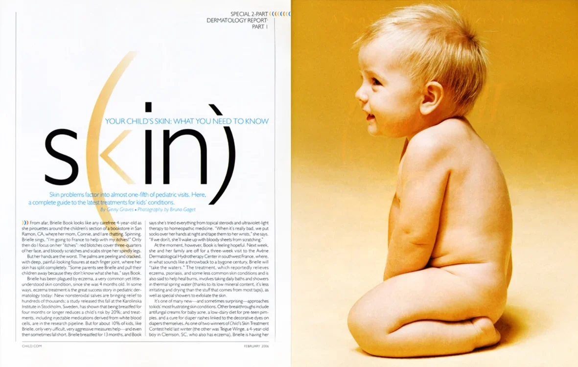 A magazine spread with an article on children's skin and a side profile of a smiling, shirtless young boy sitting on the floor.